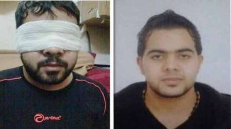 زندانی سیاسی بحرینی بینایی خود را از دست داد