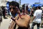 کشته شدن ده ها يمني در تهاجم عربستان به بازار حجه
