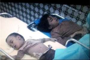 گزارش یونیسف از کشتار کودکان در یمن