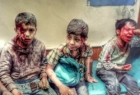 تحقیقات یونیسف درباره کودک کشی ائتلاف سعودی در یمن