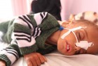یمنی ها از سوء تغذیه شدید رنج می برند