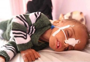 اوضاع بد بهداشتی و غذایی یمن/افزایش سوء تغذیه کودکان یمنی