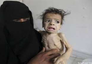 جان باختن  ۱۴۰۰ کودک یمنی از ابتدای تجاوز سعودی تاکنون