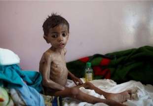 العدوان السعودي والمجاعة في اليمن