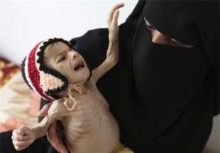 17 میلیون یمنی توانایی تأمین مواد غذایی را ندارند
