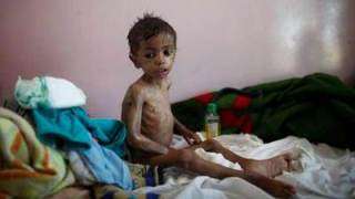 نائب بريطاني: بريطانيا متواطئة في تجويع اليمنيين