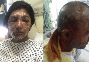 Londres : deux musulmans attaqués à l’acide