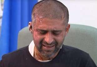 London acid attack victim Mukhtar speaks out