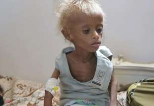 UN: Cholera is being fuelled by warring parties in Yemen