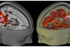 علماء: دماغ المرأة أكثر نشاطا من الرجل