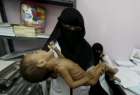 یک ‌میلیون و ۸۰۰ هزار کودک یمنی از سوء‌تغذیه شدید رنج می‌برند