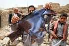 انتشار آمار تلفات مردم یمن از آغاز تجاوز عربستان به این کشور