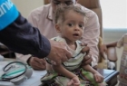 3 میلیون کودک یمنی دچار سوء تغذیه اند