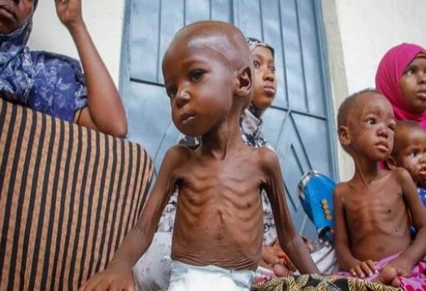 روایتی دردناک از گرسنگی مرگبار کودکان سومالی