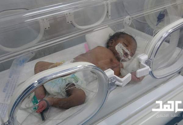 سعودیوں کے پوشیدہ جرائم؛ یمنی بچوں پیدائشی معذوری کا شکار