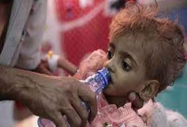 UNICEF warns millions of Yemeni children at risk of starvation