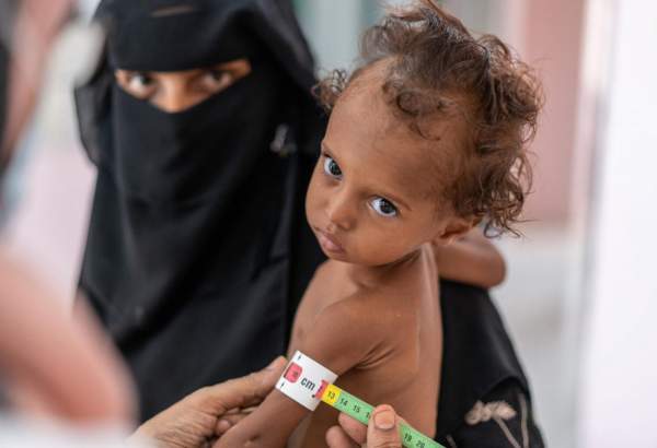 WFP halts malnutrition prevention activities in Yemen over lack of funds